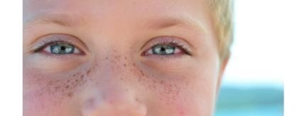 التصبغات الجلدية... أسبابها وطرق علاجها
