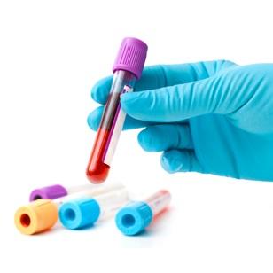 إحتياطات يجب إتباعها قبل إجراء التحاليل الطبية