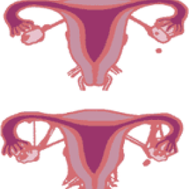 إلتصاقات ما بعد الولادة: أسباب ونتائج وعلاج
