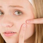 حب الشباب لدى المتزوجات